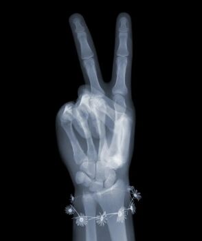 Peace with Daisies (3/25) by Nick Veasey